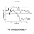 Sensorimotor Rythms (SMR)-based BCI